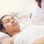 Manfaat Terapi Akupunktur Yang Unggul
